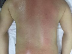 -安琪盲人按摩调理草本熏蒸馆(风和日丽店)