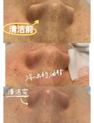 -SKIN79皮肤管理中心
