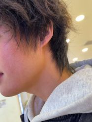 -长沙雅美医疗美容医院