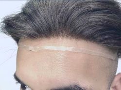 -发饰美男士增发补发假发定制店