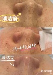 -SKIN79皮肤管理中心