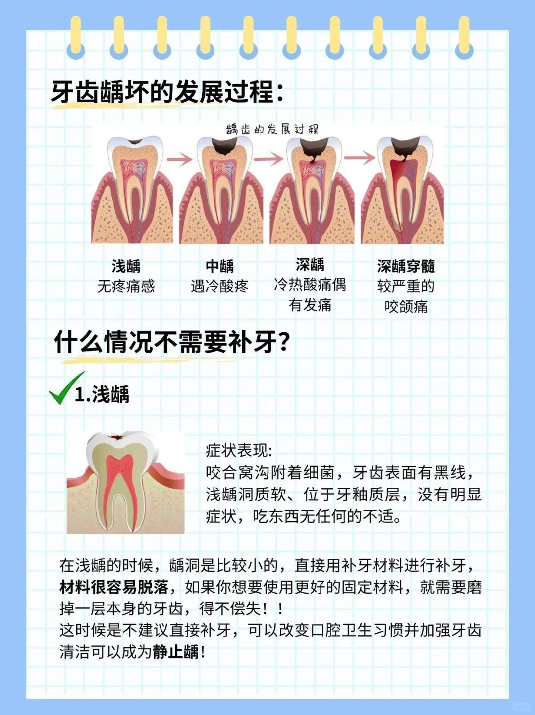 蛀牙可以恢复小窍门图片