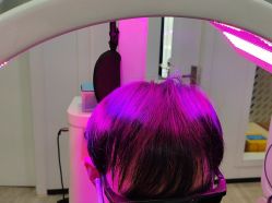 体验后-雍禾植发全国连锁