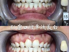 -Dr.Z dental仁康种植矫正中心