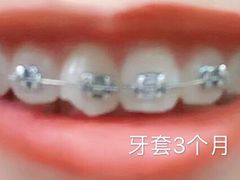 -永靓口腔.数字化种植矫正中心