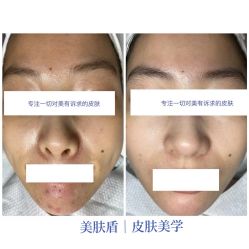 -美肤盾祛痘·问题肌头疗管理中心