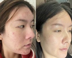 -SKIN79皮肤管理中心