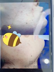 -蕾特恩专业祛痘·皮肤管理