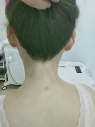 -薇兰专业脱毛连锁机构