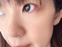 -浙江大学医学院附属第二医院眼科中心