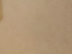 -薇兰专业脱毛连锁机构