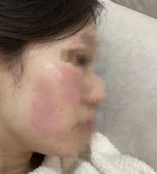 -张小熊连锁轻医美