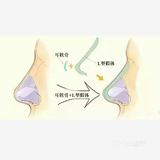 行业内的㊙密，你是否被伪鼻综合迷惑❗❗