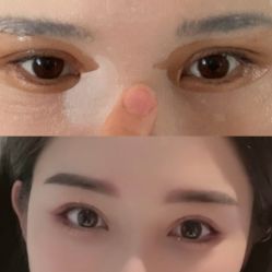 体验前-成都艾特他整形外科医院