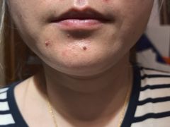 -复旦大学附属华山医院(总院)