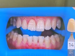 -极光口腔·矫正种植修复(锦江院区)