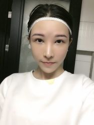 -大麦微针植发丨全国连锁