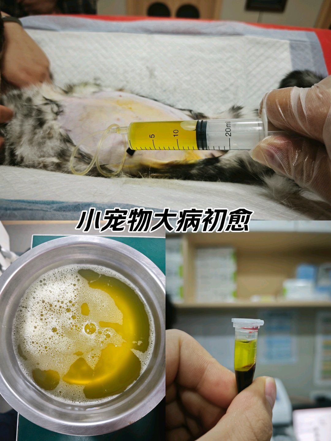腹水