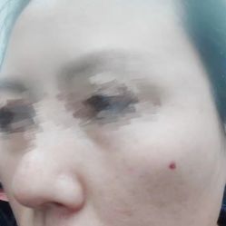 -新美荟医美·专注面部美学抗衰