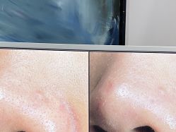 -苑苑vbeauty科技美容SPA
