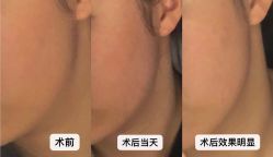 -深圳春天阳光医院·轮廓抗衰中心