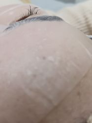 -宁波美莱整形美容