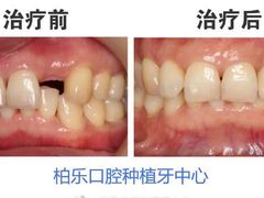 -柏乐口腔医院·舒适化无痛种植牙中心(东盟商务区院)