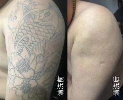 -恒古刺青·祛除纹身·手工穿孔饰品