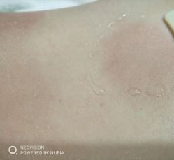 点击看大图 -苑苑vbeauty科技美容SPA