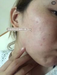 -MLP美丽派·问题肌疗愈中心