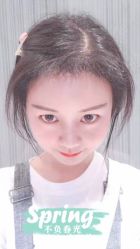 体验后-大麦微针植发全国连锁