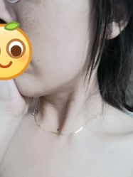 -痣清宫祛斑祛痣连锁店