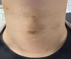 -深圳米兰柏羽医疗美容医院