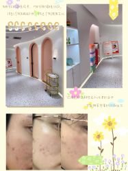 -苗方清颜痘肌研究所