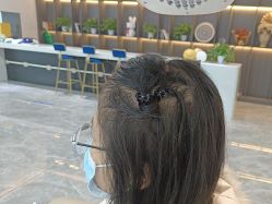 -碧莲盛·不剃发植发
