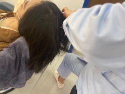 -大麦微针植发全国连锁