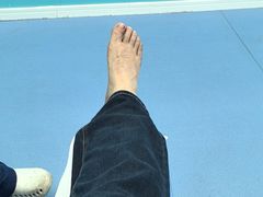 -Andrew指甲专科灰指甲·甲沟炎矫正·3D步态矫形鞋垫定制(浦三路店)