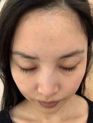 体验后-成都艾特他整形外科医院