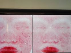 -苑苑vbeauty科技美容SPA