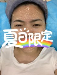 体验前-成都西区医院整形美容