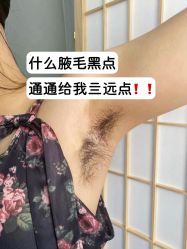 -薇兰专业脱毛连锁机构