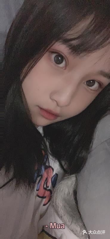 双眼皮术后修复必备指南🔍疤痕体质看过来❗️