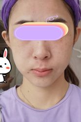 点击看大图 体验前-广州美莱医疗美容医院