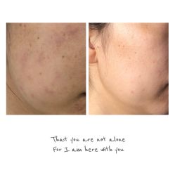 -夸迪QUADHA肌肤定制