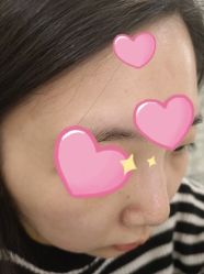 -清颜堂丨分子祛痘·功效美肤