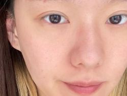 -东莞缔美美容医院