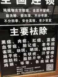 -痣缘宫
