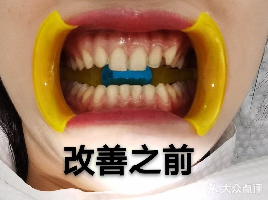 做下来进口的才30000/好像国产的更便宜