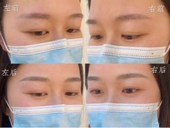 点击看大图 -久匠·纹眉纹绣半永久