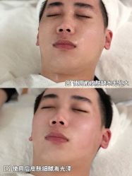 -skin79皮肤管理基站